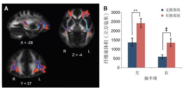 聽(tīng)音樂(lè)起雞皮疙瘩？你可能真的天賦異稟