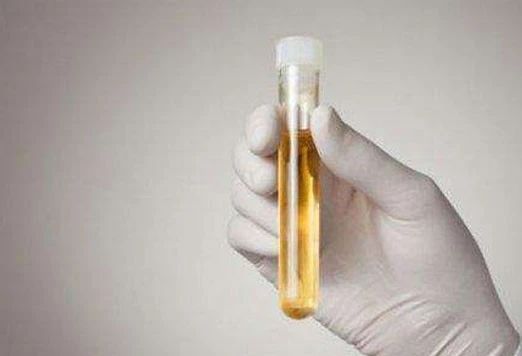 注意！6大表現(xiàn)警惕肝臟出現(xiàn)問(wèn)題 