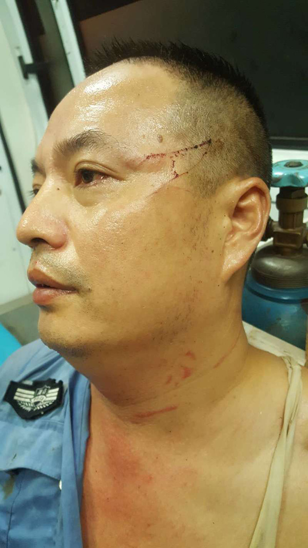 被持刀歹徒劫持5小時，黃其煥身上被刀劃傷26處，幸無大礙。警方供圖