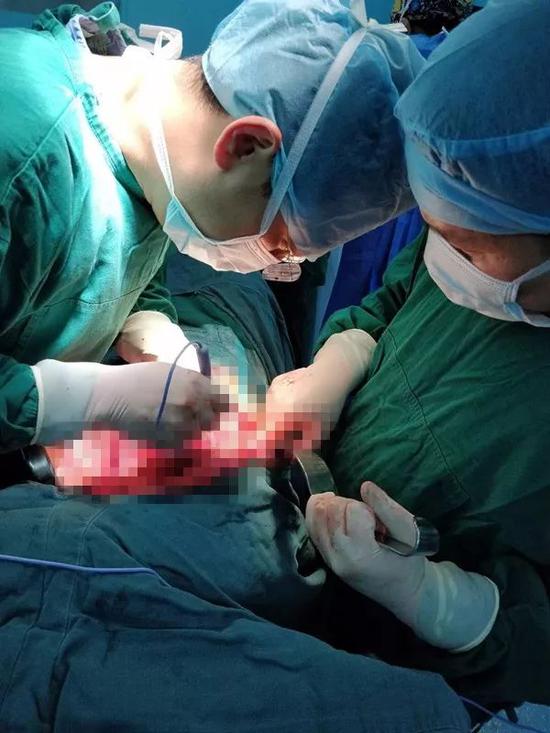 手術中的馮侃醫生（左）