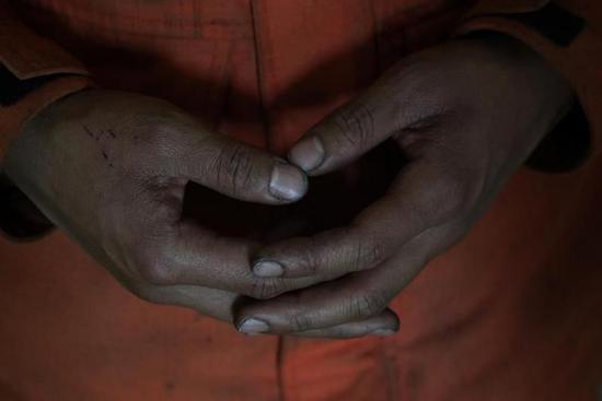 ?手上留下的大火的黑色印跡難以洗掉