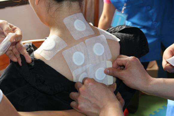 三伏貼每個(gè)人貼的中藥都一樣嗎？三伏貼貼的位置在哪里？