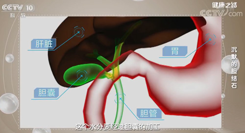 【名醫(yī)話健康】膽結石是怎樣形成的?除了長期不吃早餐,還有這些原因……